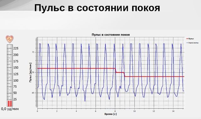 Какая норма пульса в состоянии покоя
