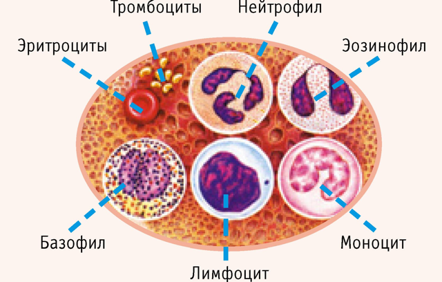 Нейтропения и ее причины. Лекарственная нейтропения