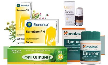 Мочекаменная болезнь симптомы и лечение у мужчин