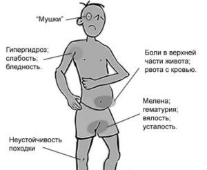 Кровотечение в кишечнике: симптомы, диагностика и способы лечения