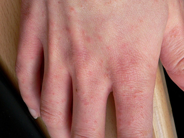 Спрегаль спрей: цена, инструкция по применению и отзывы