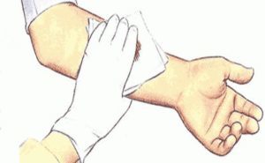 Кровотечения и способы их остановки