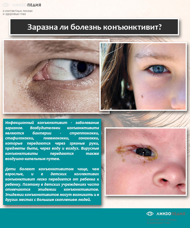 Сульфацил натрия – капли глазные: описание, состав, инструкция