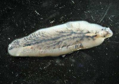 Билиарная гипертензия печени: симптомы, признаки на УЗИ и лечение синдрома