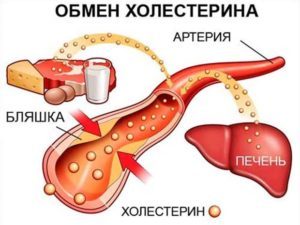 Какой врач лечит сосуды головного мозга, атеросклероз?