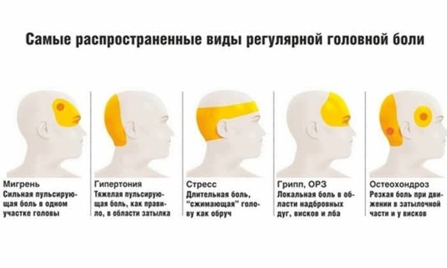 Всё о головной боли: характер, виды, первичная, вторичная