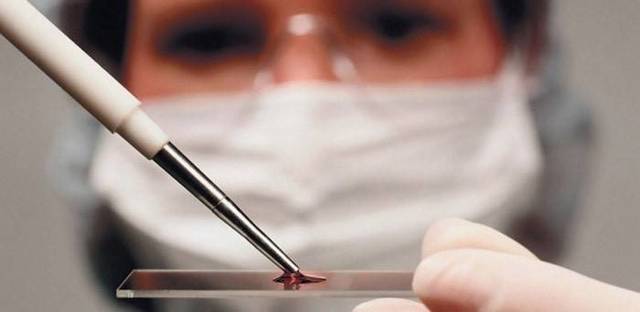 Редкая кровь какая