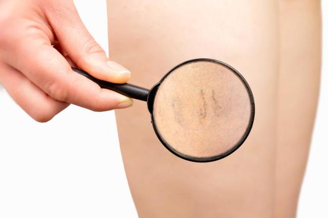 Аскорутин инструкция по применению для чего назначают - Здоровье и долголетие