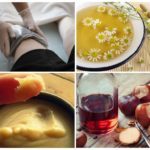 Внутренний варикоз на ногах (скрытый): симптомы и лечение