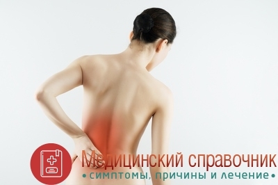 Лордоз – что это такое, как лечить и предупредить