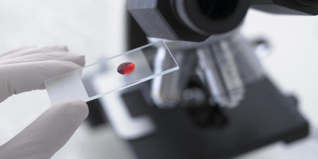 Как понизить билирубин в крови: лекарства и народные рецепты