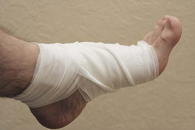 Артрит стопы симптомы и лечение — Суставы