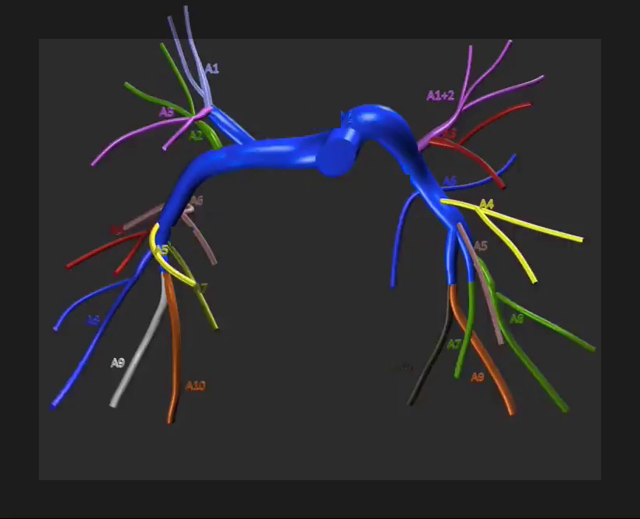 Анатомия сосудов легких. Легочная артерия