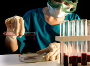 Анализ крови ПСА — что это такое? Расшифровка и норма