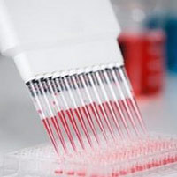 ИФА анализ крови: что такое, почему положительный, расшифровка теста