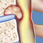 О Чем Говорит Боль в Грудной Клетке Посередине