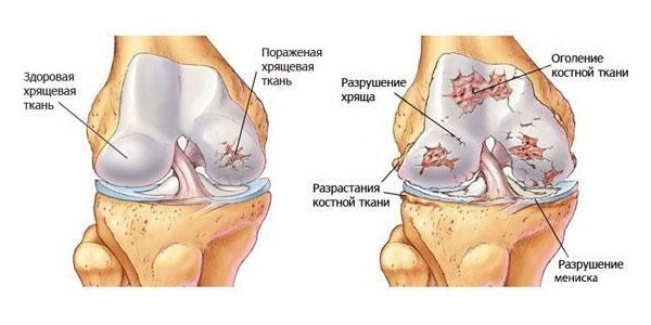Напроксен-акри - 1 отзыв, цена от 80 руб., инструкция по применению