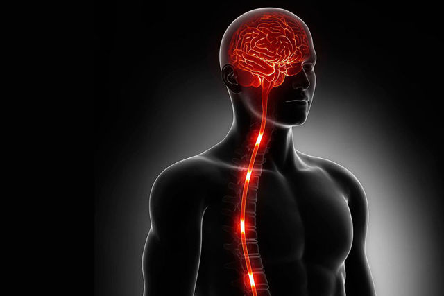 Инсульт спинного мозга (спинальный): симптомы, лечение, последствия