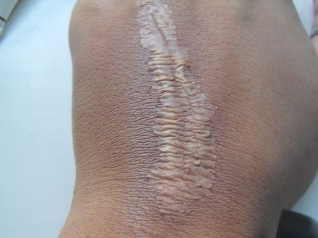 Ацербин спрей: инструкция по применению, показания, цена, отзывы врачей, аналоги спрея Ацербин