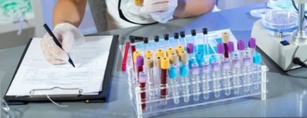 Повышенный калий в крови, причины и симптомы высокого калия в крови