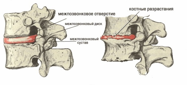 О Чем Говорит Боль в Грудной Клетке Посередине