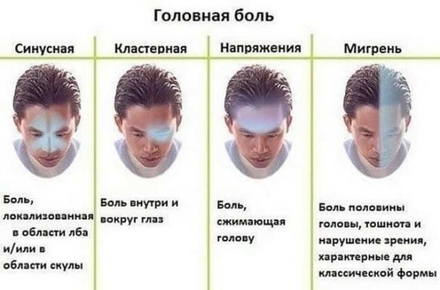 Боли в голове при всд характер течения и методы терапии