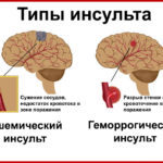 Красное пятно в глазу - причины и лечение
