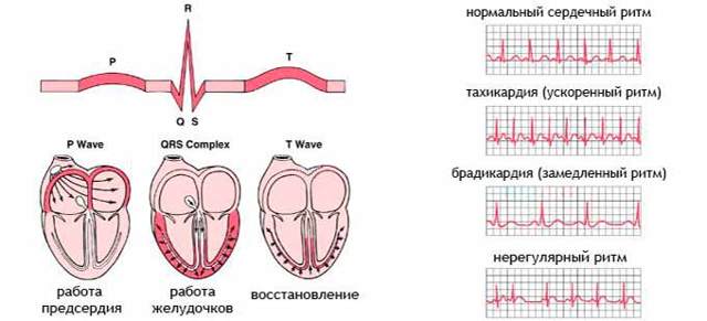 Экг отведения по слопаку - Лечение гипертонии
