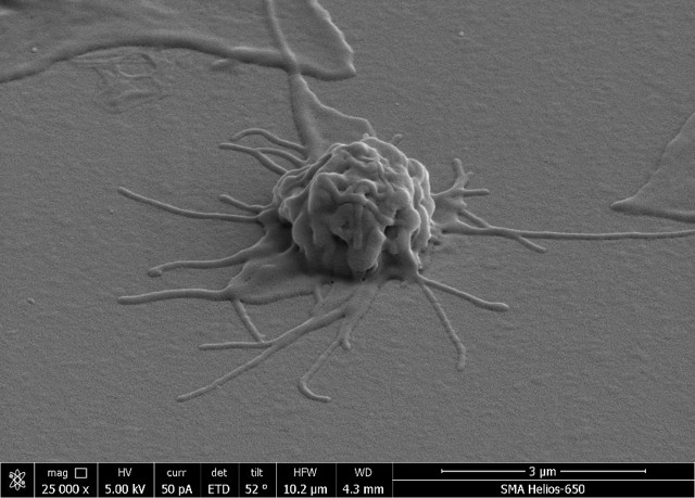 Тромбоциты., Свойства тромбоцитов., Функции тромбоцитов. - Форменные элементы крови. Норма и патология