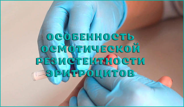 КИСЛОТНАЯ И ОСМОТИЧЕСКАЯ УСТОЙЧИВОСТЬ ЭРИТРОЦИТОВ ПЕРИФЕРИЧЕСКОЙ КРОВИ ЧЕЛОВЕКА ПРИ ДЕЙСТВИИ СТРЕССОВЫХ ФАКТОРОВ РАЗЛИЧНОГО ГЕНЕЗА - Современные проблемы науки и образования (научный журнал)