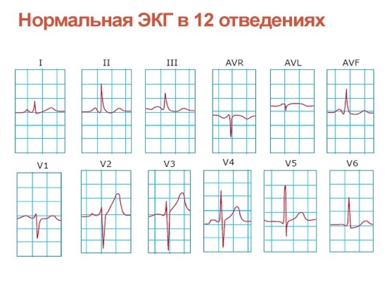 ЭКГ сердца - алгоритм действия (рекомендации)