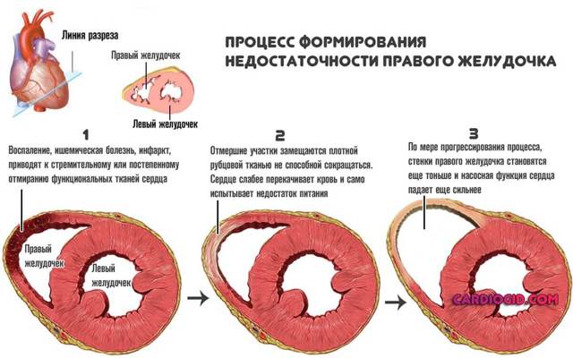 Антикоагулянты – механизм действия, список препаратов