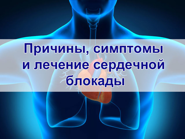 Блокада сердца - что это такое? Причины, симптомы и лечение блокады сердца