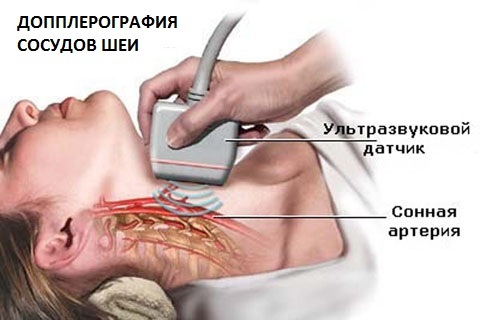 УЛЬТРАЗВУКОВАЯ ОЦЕНКА ДИНАМИКИ КРОВОТОКА В ПОЗВОНОЧНЫХ АРТЕРИЯХ ПРИ ПОВОРОТАХ ГОЛОВЫ - Фундаментальные исследования (научный журнал)
