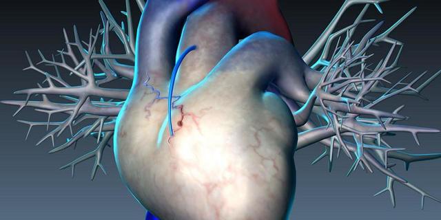 От чего происходит инфаркт миокарда