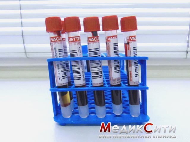 Васкулит как долго лечится. Васкулит – опасное заболевание кровеносных сосудов