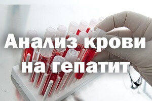 Анализ крови на гепатит и ВИЧ - сколько и как делается