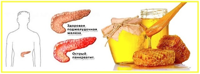 Можно ли есть мед при панкреатите поджелудочной железы или нет, лечение
