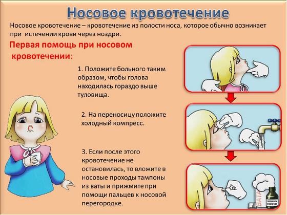 Кровь из носа: причины у взрослых и детей, как остановить кровотечение
