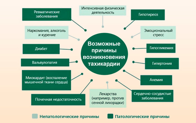 Тахикардия - причины, виды, симптомы, диагностика, лечение
