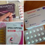 Отеки при варикозе - снимаем быстро и надолго