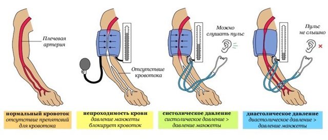 Систолическое артериальное давление: что это такое