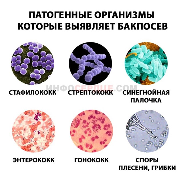 Анализ крови на стерильность – зачем нужен и кому показан?