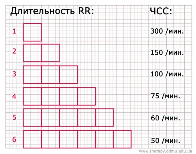 Онлайн-курс ЭКГ: ЧСС, способы ее подсчета