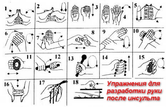 Упражнения для ног после инсульта