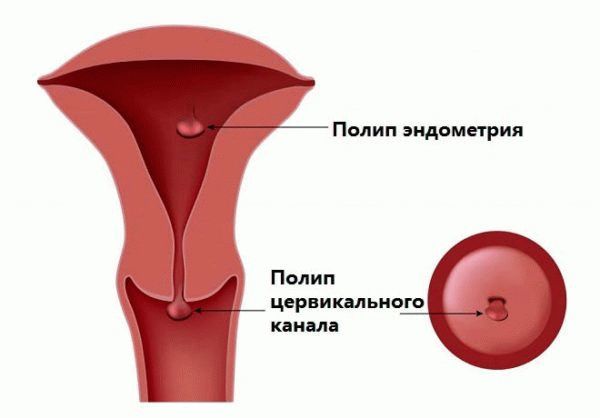 Коричневые выделения при беременности на ранних сроках: светло, темно коричневые в первом триместре на 3-5, 6-12 неделях