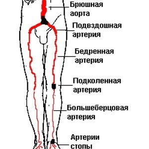 Окклюзия артерий нижних конечностей: что это такое и её лечение