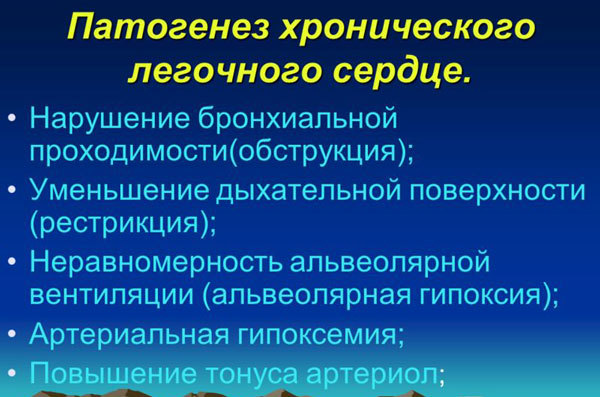 Патогенез легочного сердца - хронического или острого