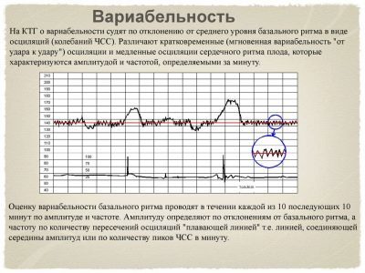 КТГ при беременности: расшифровка и норма, сроки и что показывает по неделям - видео
