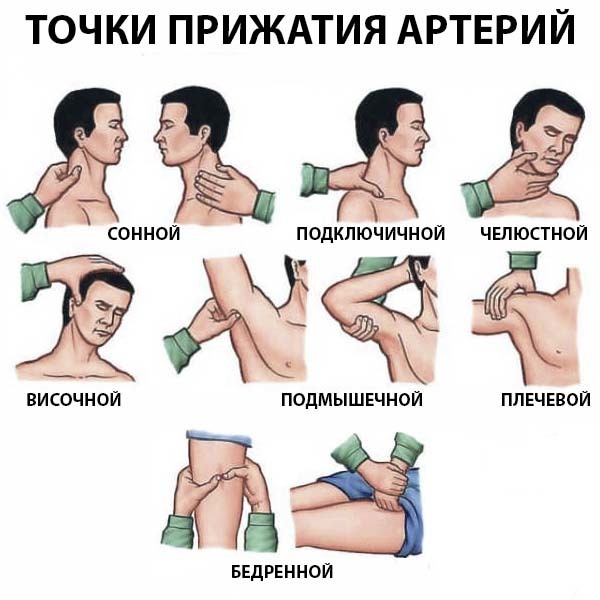 Пальцевое прижатие артерий при кровотечениях: точки и места прижатия